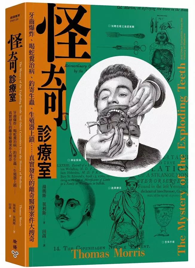 怪奇診療室：牙齒爆炸、喝蛇糞治病、釣寄生蟲、生殖器上鎖……真實發生的離奇醫療案件大搜奇